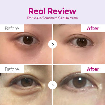 Dr. Melaxin Cemenrete Calcium Intense Cream 50ml | Firming & Barrier Care – MyKStyle - Mykstyle